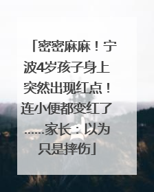 密密麻麻！宁波4岁孩子身上突然出现红点！连小便都变红了……家长：以为只是摔伤